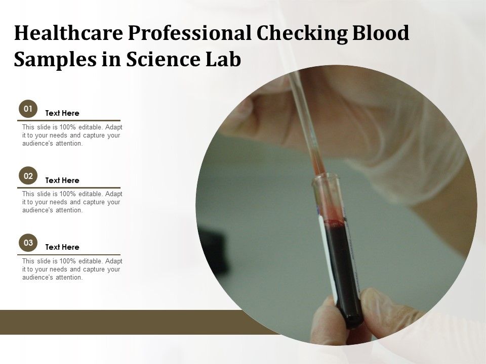 Healthcare_Professional_Checking_Blood_Samples_In_Science_Lab_Ppt_PowerPoint_Presentation_Summary_Slide_Download_PDF_Slide_1.jpg