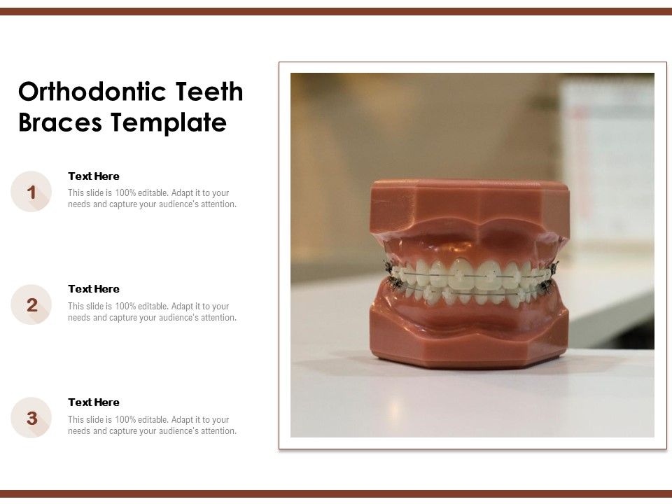 Orthodontic_Teeth_Braces_Template_Ppt_PowerPoint_Presentation_Slide_PDF_Slide_1.jpg