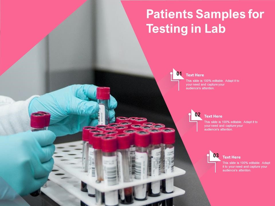 Patients_Samples_For_Testing_In_Lab_Ppt_PowerPoint_Presentation_Gallery_Slide_Portrait_PDF_Slide_1.jpg