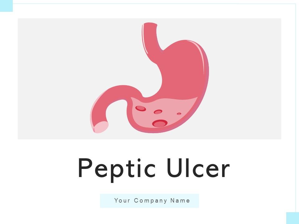 Peptic_Ulcer_Abdomen_Area_Health_Issues_Ppt_PowerPoint_Presentation_Complete_Deck_Slide_1.jpg