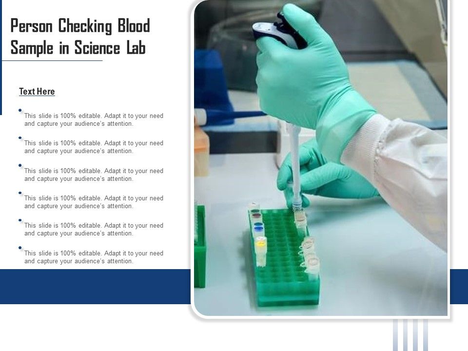 Person_Checking_Blood_Sample_In_Science_Lab_Ppt_PowerPoint_Presentation_File_Template_PDF_Slide_1.jpg