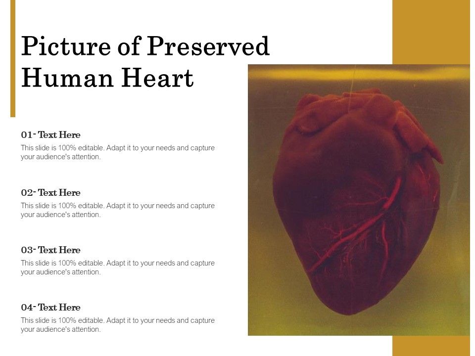 Picture_Of_Preserved_Human_Heart_Ppt_PowerPoint_Presentation_Professional_Smartart_PDF_Slide_1.jpg