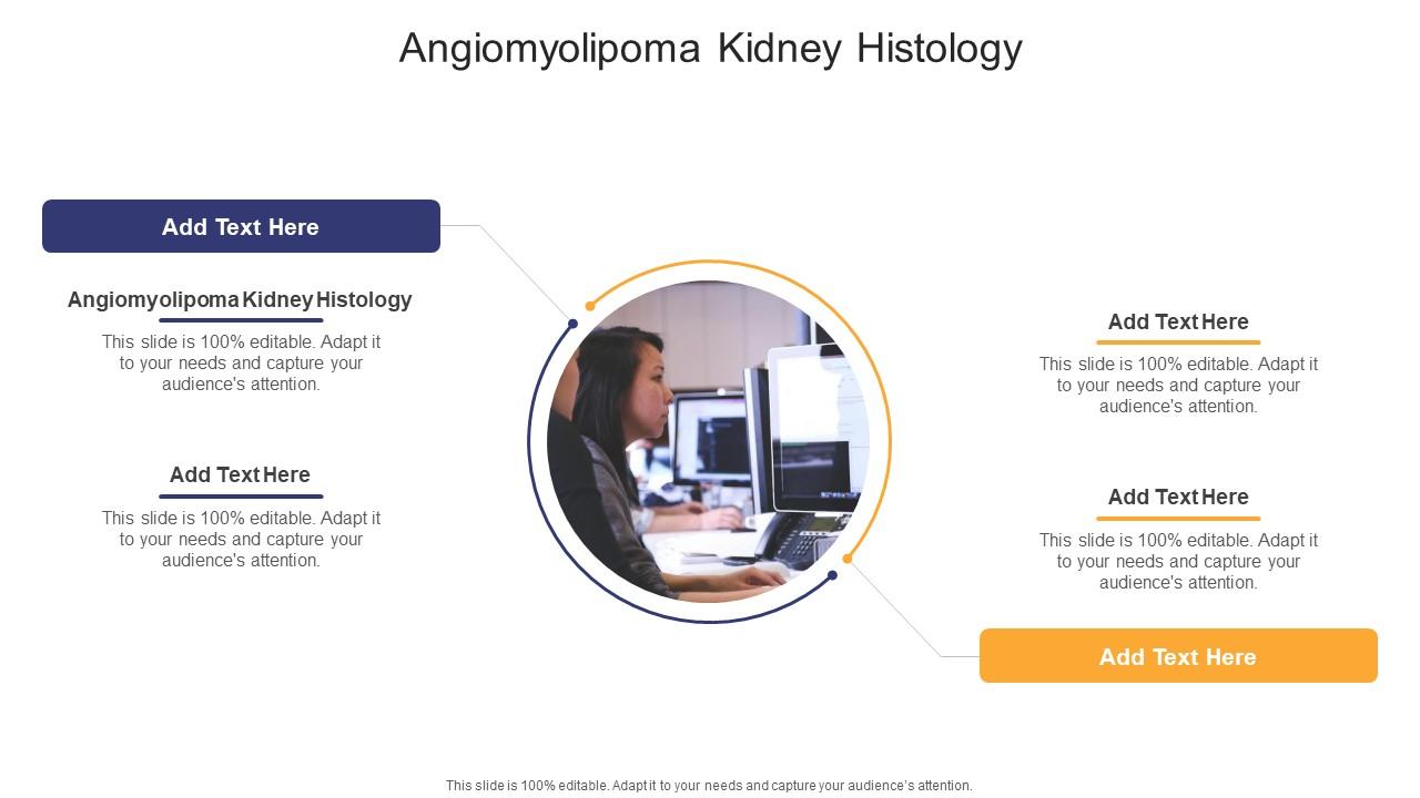 Angiomyolipoma Kidney Histology In Powerpoint And Google Slides Cpb