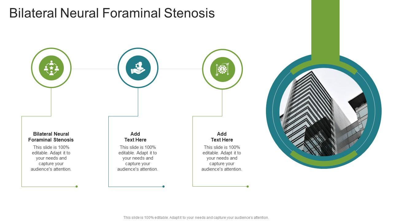 Bilateral Neural Foraminal Stenosis In Powerpoint And Google Slides Cpb