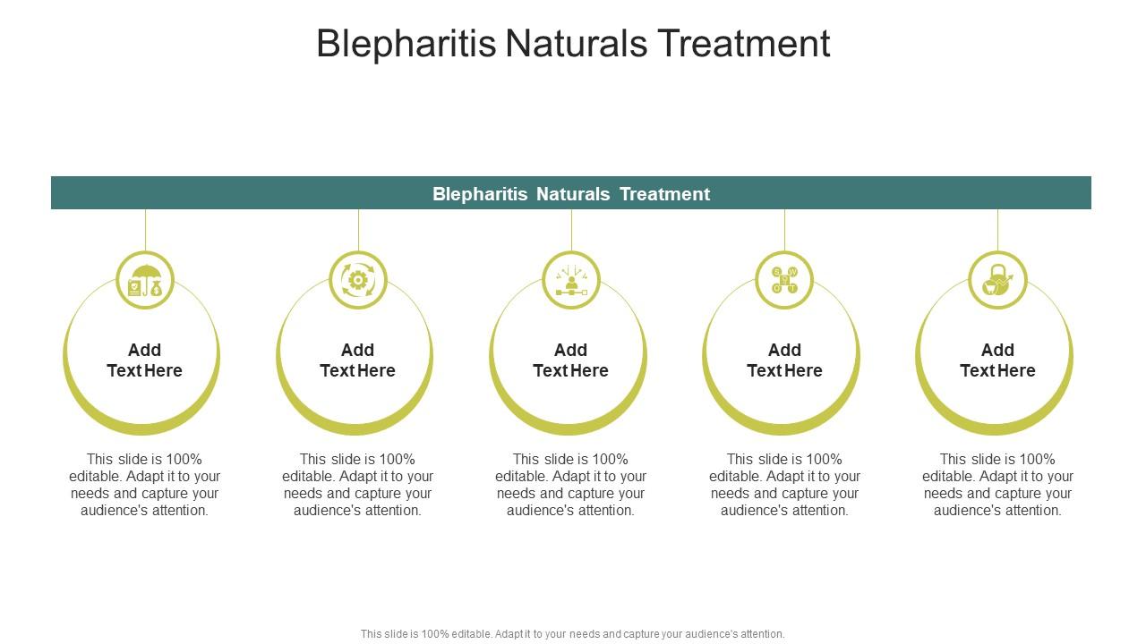 Blepharitis Naturals Treatment In Powerpoint And Google Slides Cpb