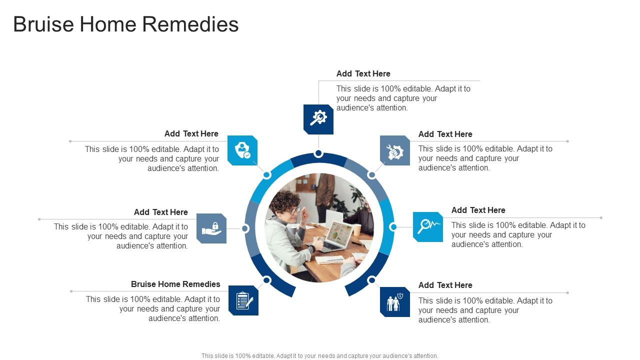 Bruise Home Remedies In Powerpoint And Google Slides Cpb