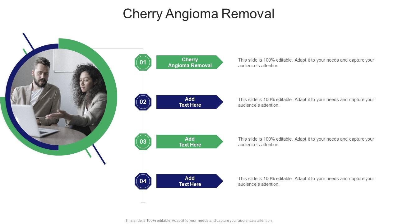 Cherry Angioma Removal In Powerpoint And Google Slides Cpb