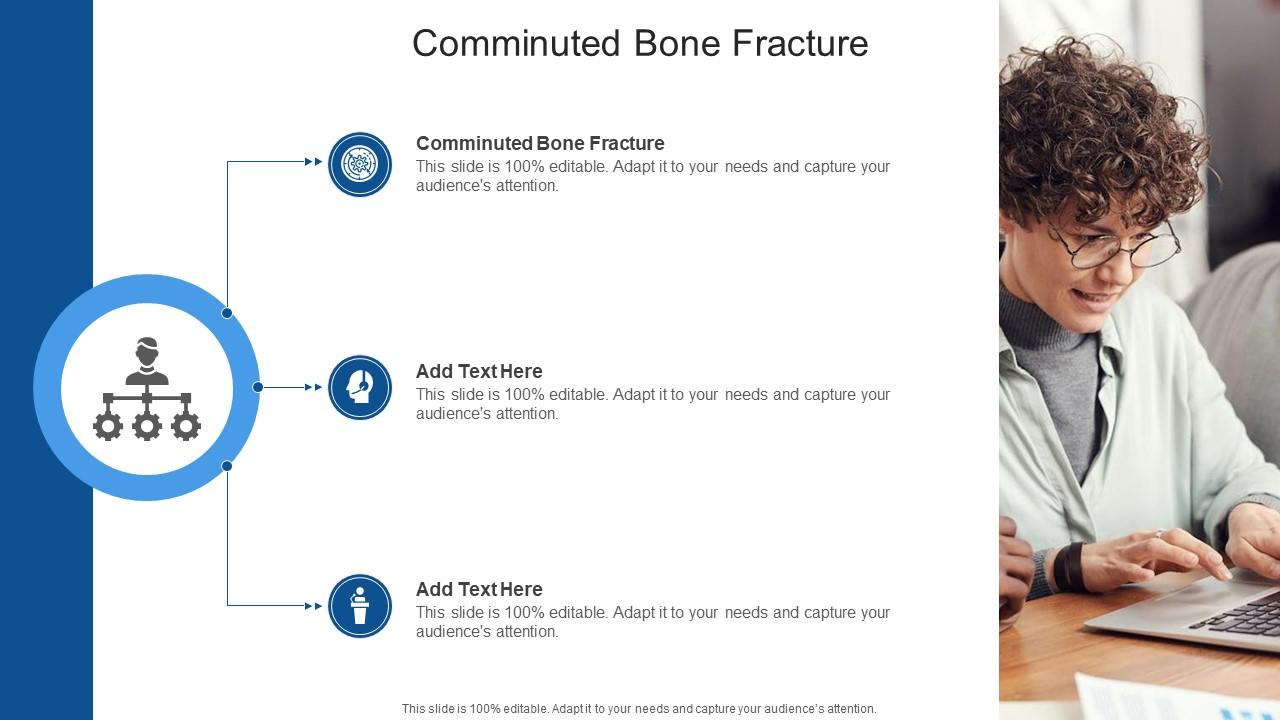 Comminuted Bone Fracture In Powerpoint And Google Slides Cpb