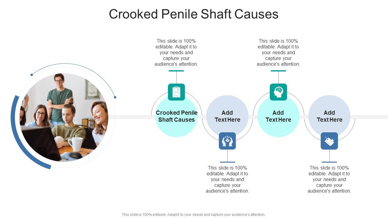 Crooked Penile Shaft Causes In Powerpoint And Google Slides Cpb