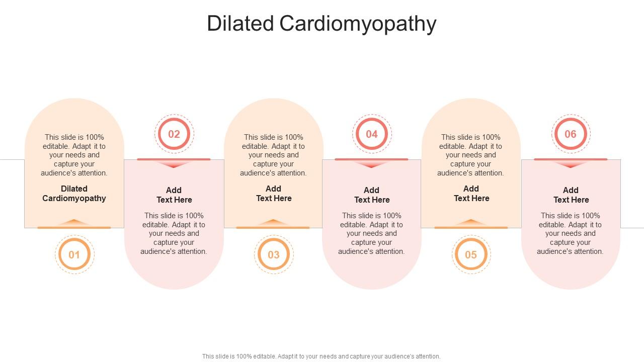 Dilated Cardiomyopathy In Powerpoint And Google Slides Cpb