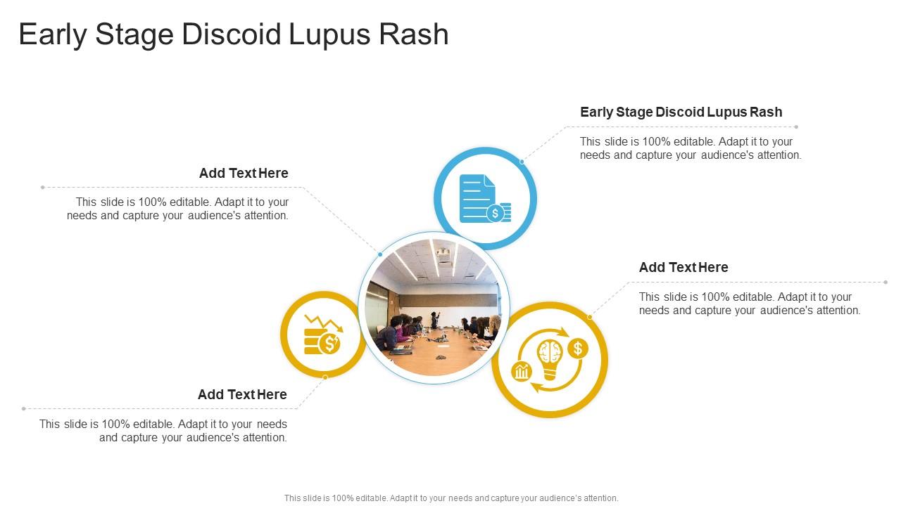 Early Stage Discoid Lupus Rash In Powerpoint And Google Slides Cpb