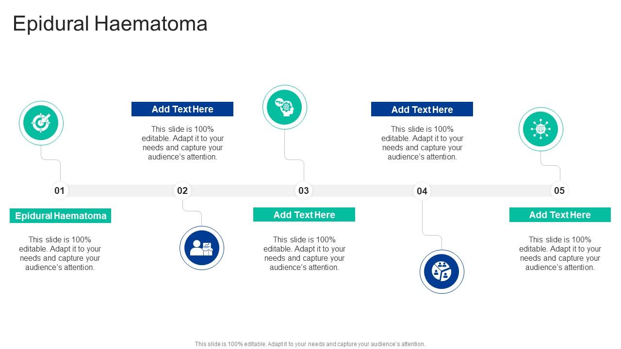 Epidural Haematoma In Powerpoint And Google Slides Cpb