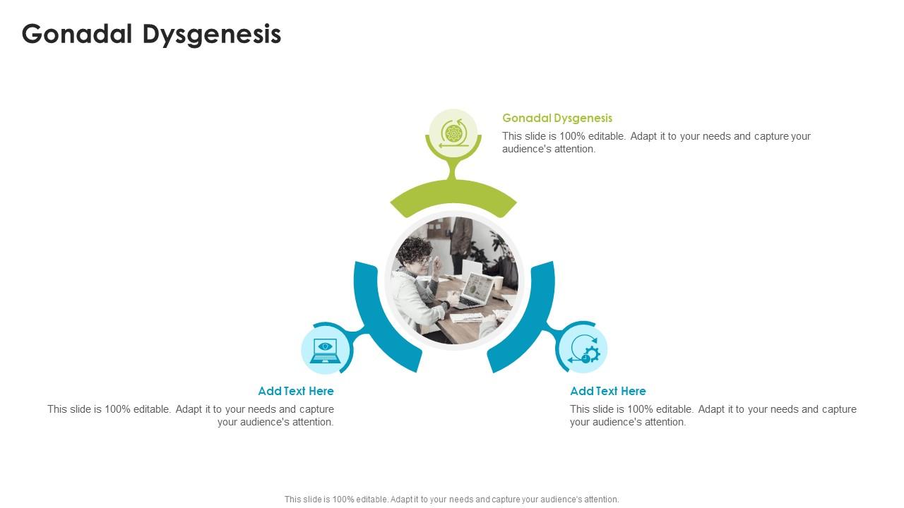 Gonadal Dysgenesis In Powerpoint And Google Slides Cpb