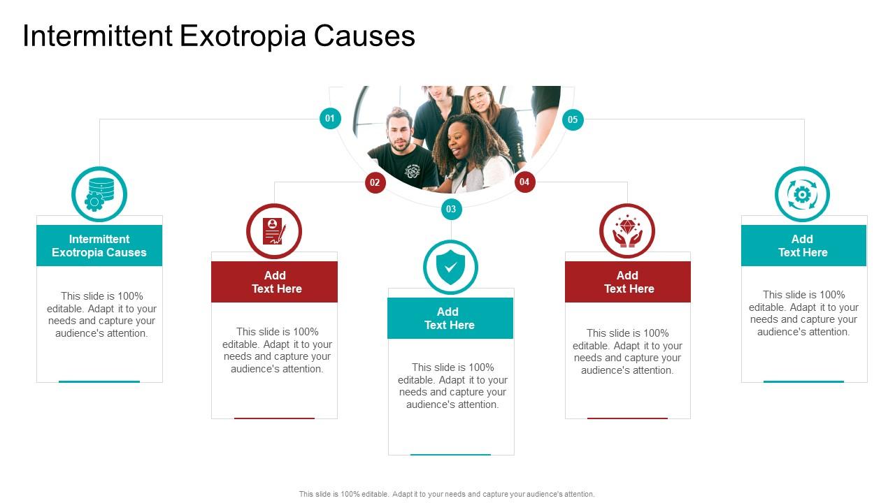 Intermittent Exotropia Causes In Powerpoint And Google Slides Cpb