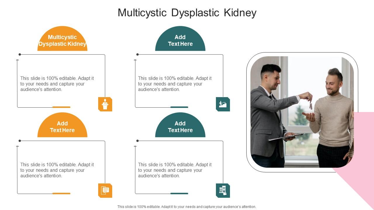 Multicystic Dysplastic Kidney In Powerpoint And Google Slides Cpb