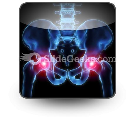 pain_in_hips_powerpoint_icon_s.jpg
