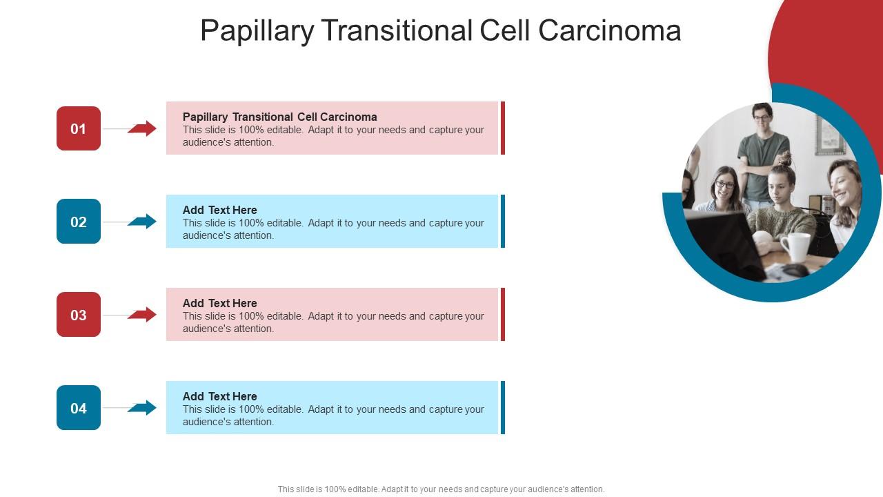 Papillary Transitional Cell Carcinoma In Powerpoint And Google Slides Cpb