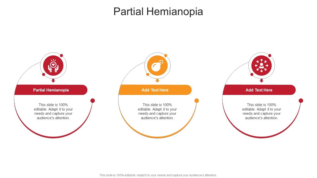Partial Hemianopia In Powerpoint And Google Slides Cpb