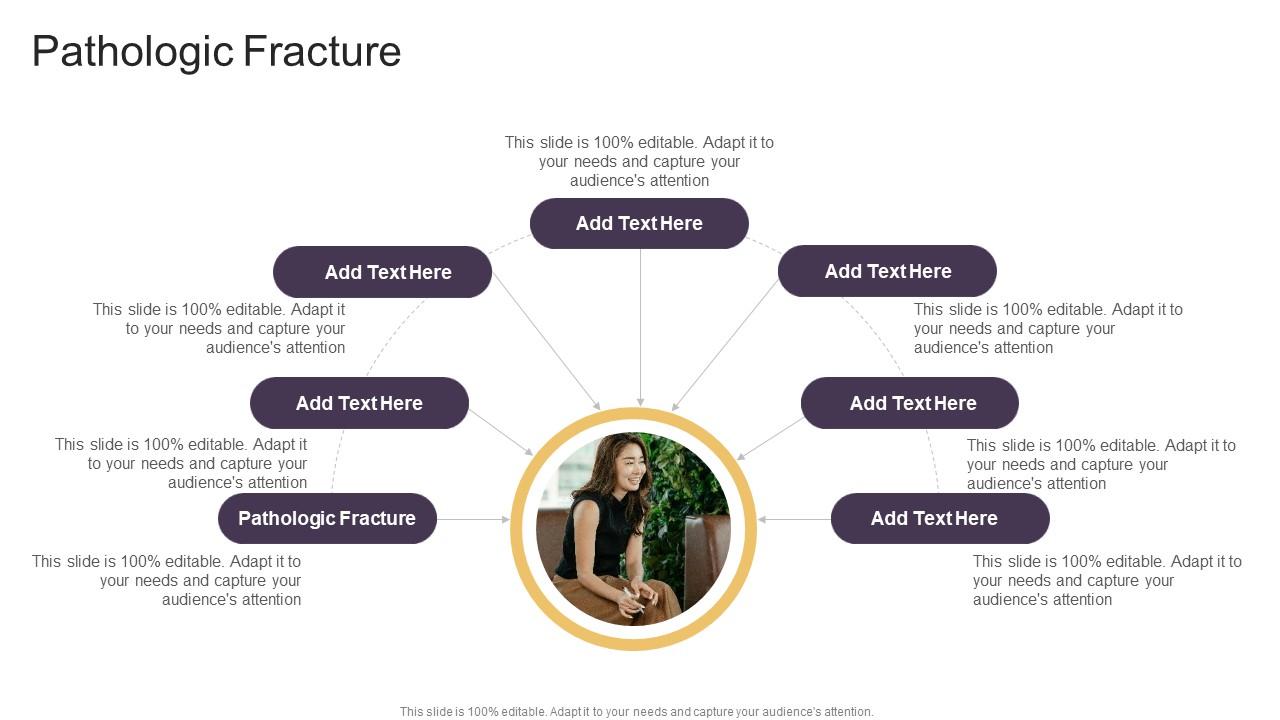 Pathologic Fracture In Powerpoint And Google Slides Cpb