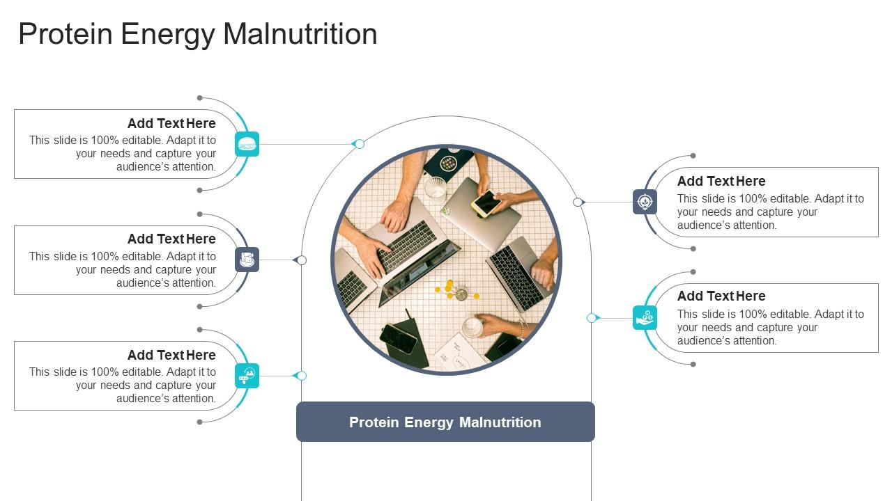 Protein Energy Malnutrition In Powerpoint And Google Slides Cpb