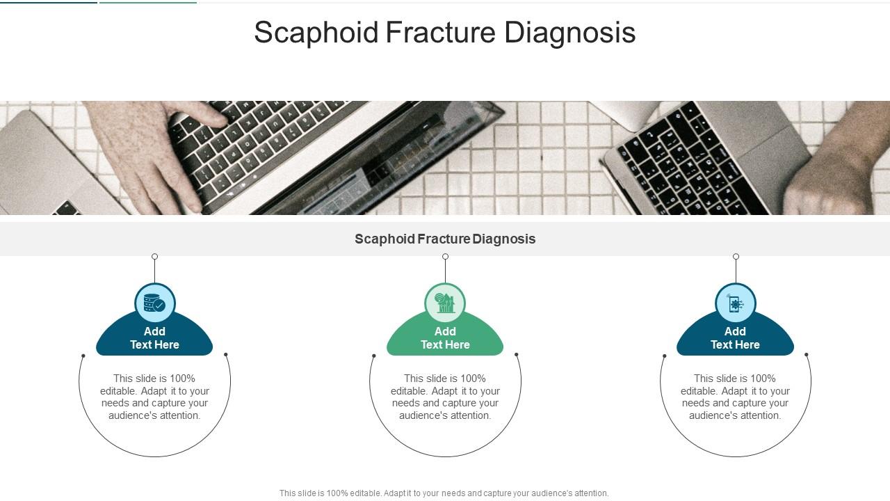 Scaphoid Fracture Diagnosis In Powerpoint And Google Slides Cpb