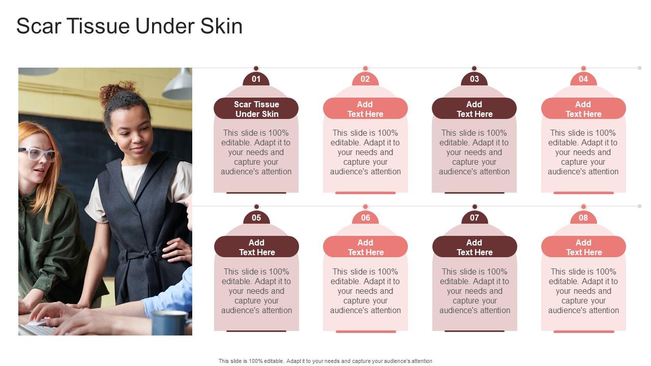 Scar Tissue Under Skin In Powerpoint And Google Slides Cpb