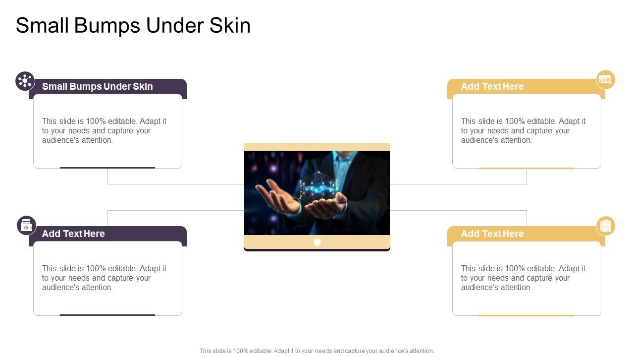 Small Bumps Under Skin In Powerpoint And Google Slides Cpb