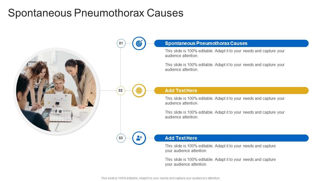 Spontaneous Pneumothorax Causes In Powerpoint And Google Slides Cpb