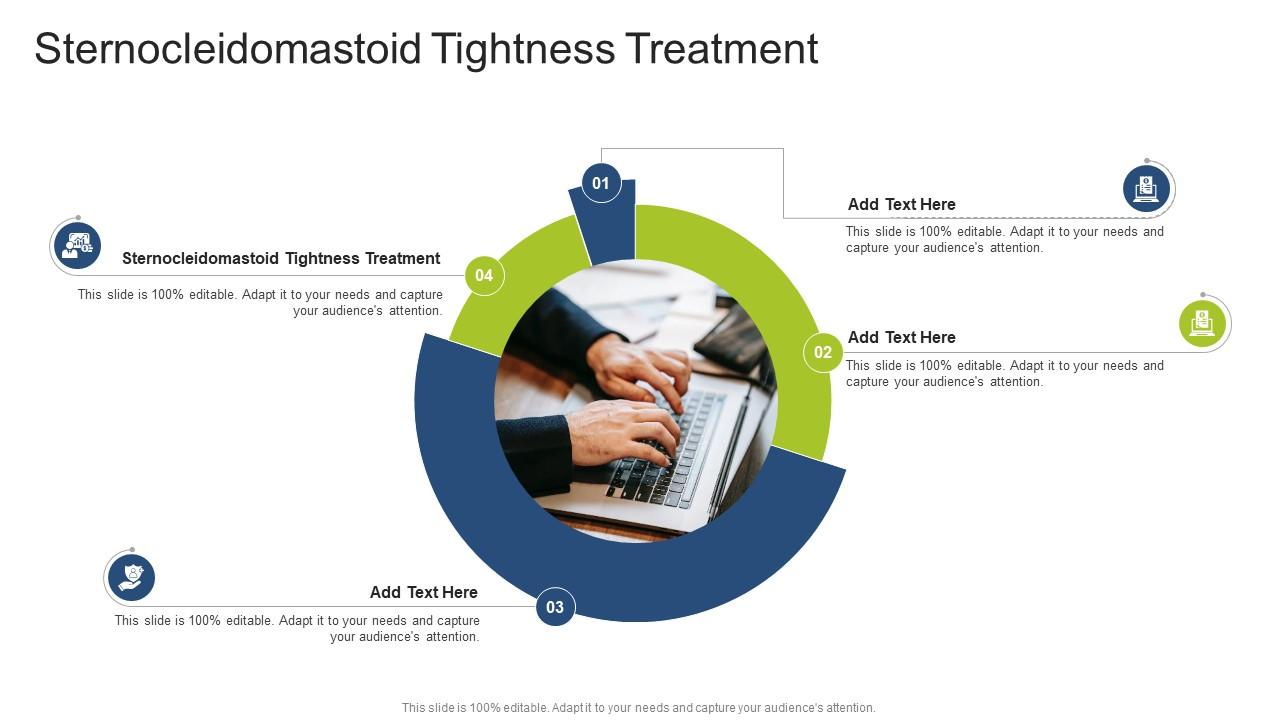 Sternocleidomastoid Tightness Treatment In Powerpoint And Google Slides Cpb