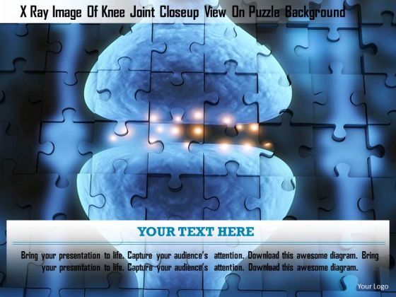 stock_photo_x_ray_image_of_knee_joint_closeup_view_on_puzzle_background_powerpoint_slide_1.jpg