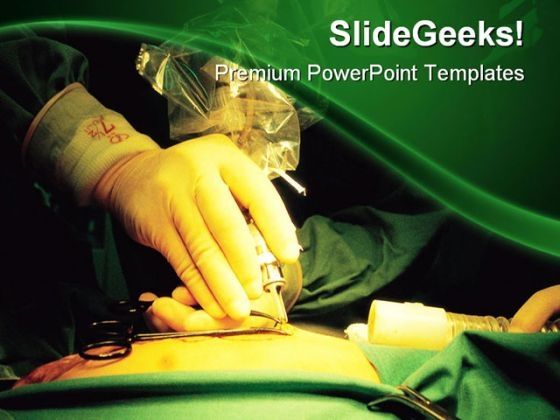 surgeon_hand_medical_powerpoint_templates_and_powerpoint_backgrounds_0211_title.jpg