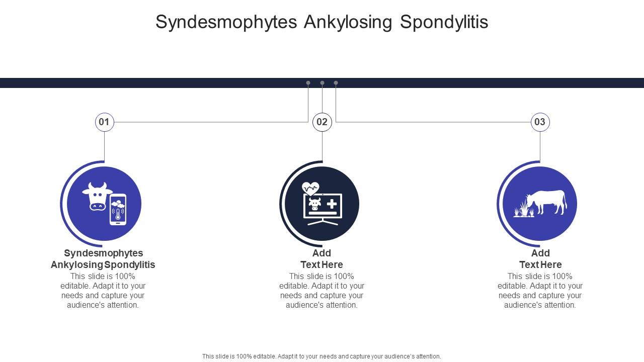 Syndesmophytes Ankylosing Spondylitis In Powerpoint And Google Slides Cpb