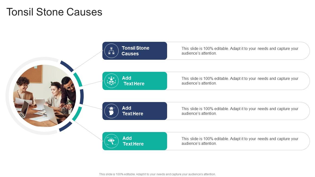 Tonsil Stone Causes In Powerpoint And Google Slides Cpb