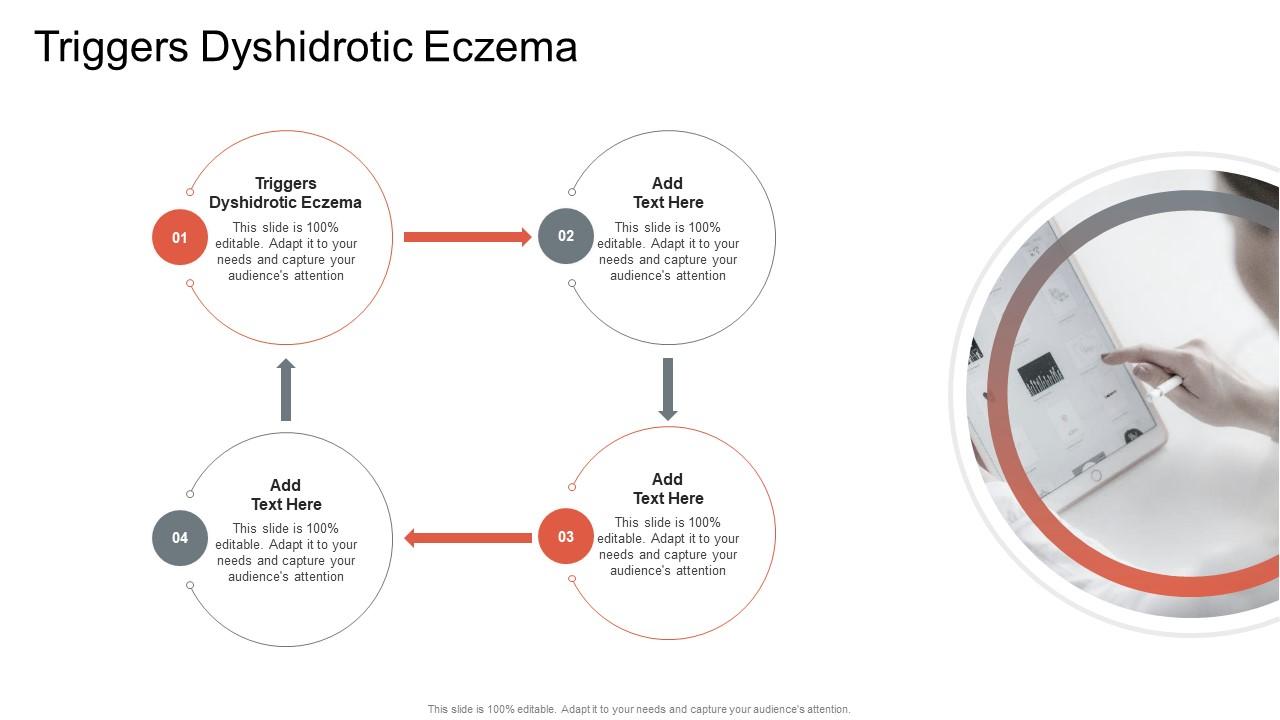 Triggers Dyshidrotic Eczema In Powerpoint And Google Slides Cpb
