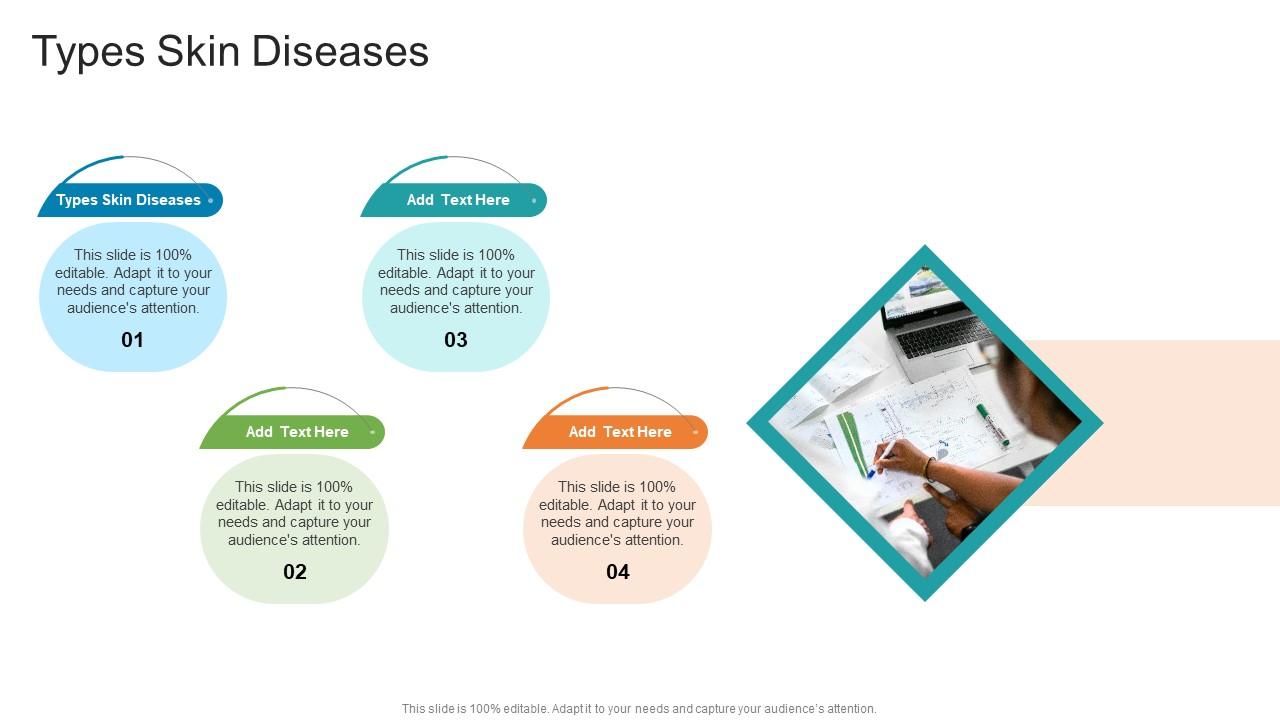 Types Skin Diseases In Powerpoint And Google Slides Cpb