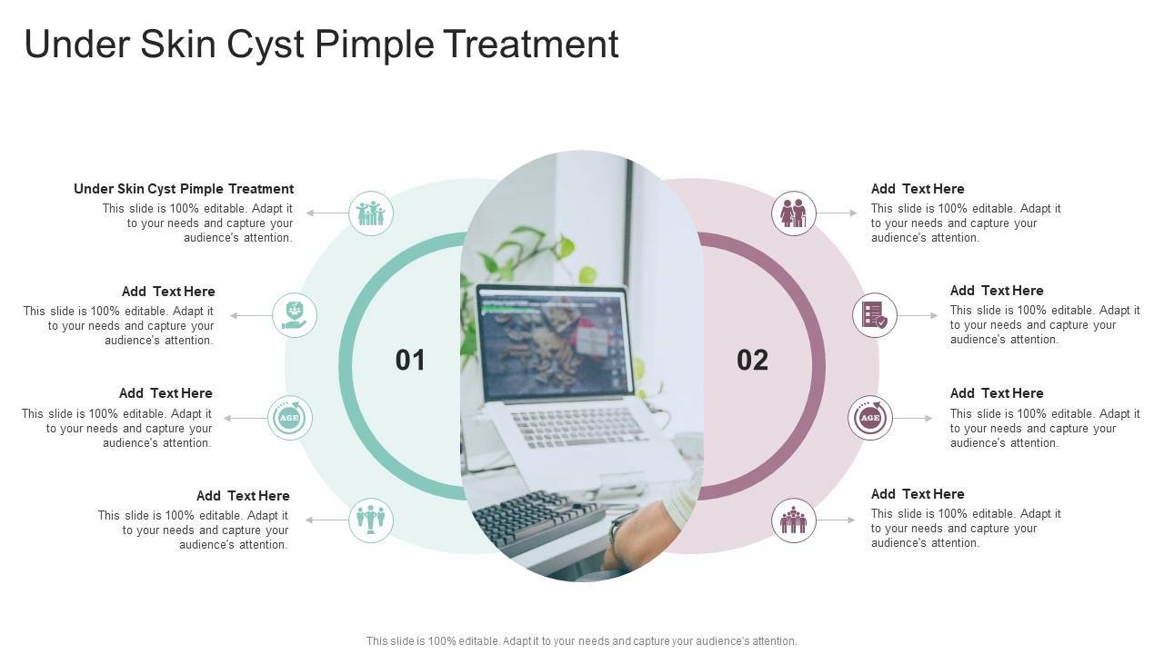 Under Skin Cyst Pimple Treatment In Powerpoint And Google Slides Cpb