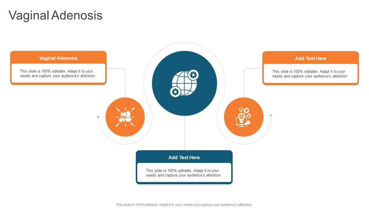 Vaginal Adenosis In Powerpoint And Google Slides Cpb