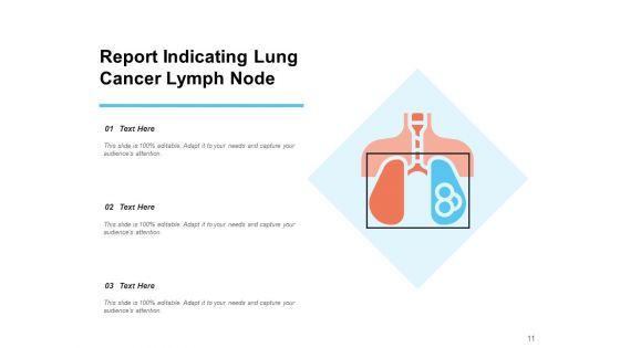 Lung Carcinoma Lung Cancer Ribbon Ppt PowerPoint Presentation Complete Deck