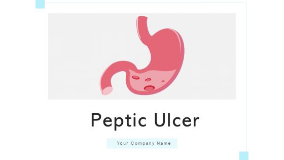 Peptic Ulcer Abdomen Area Health Issues Ppt PowerPoint Presentation Complete Deck