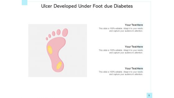 Peptic Ulcer Abdomen Area Health Issues Ppt PowerPoint Presentation Complete Deck