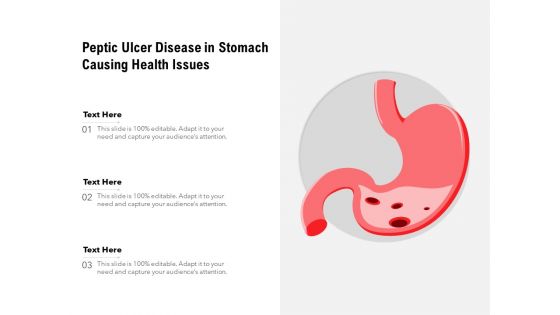 Peptic Ulcer Disease In Stomach Causing Health Issues Ppt PowerPoint Presentation Infographic Template Format Ideas PDF