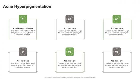 Acne Hyperpigmentation In Powerpoint And Google Slides Cpb