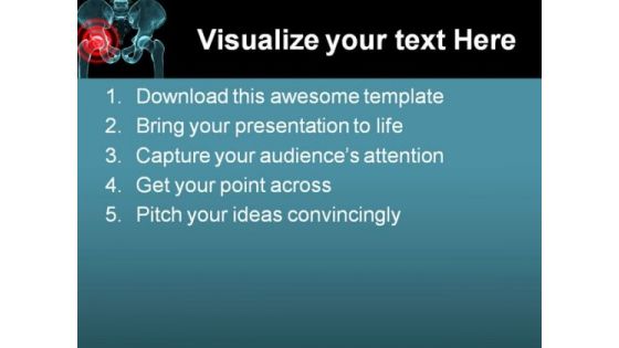 Arthritis In Hip Medical PowerPoint Themes And PowerPoint Slides 0211