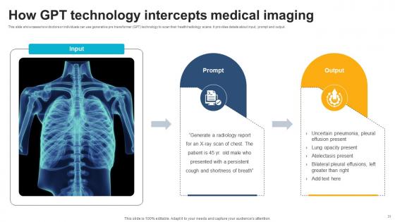 ChatGPT And Healthcare Innovation Enhancing Medical Decision Making AI CD V