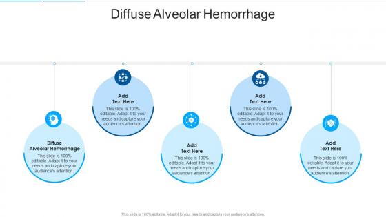 Diffuse Alveolar Hemorrhage In Powerpoint And Google Slides Cpb Diffuse Alveolar Hemorrhage In Powerpoint And Google Slides Cpb