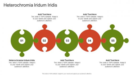 Heterochromia Iridum Iridis In Powerpoint And Google Slides Cpb Heterochromia Iridum Iridis In Powerpoint And Google Slides Cpb