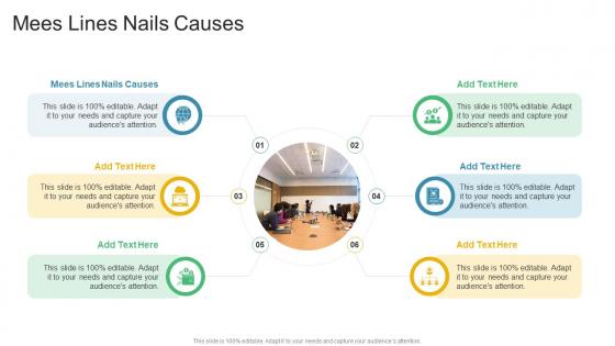 Mees Lines Nails Causes In Powerpoint And Google Slides Cpb