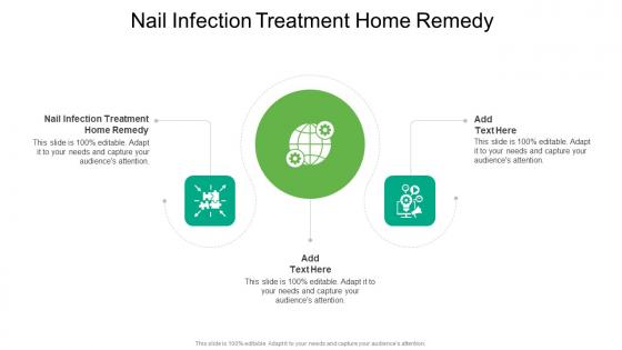Nail Infection Treatment Home Remedy In Powerpoint And Google Slides Cpb Nail Infection Treatment Home Remedy In Powerpoint And Google Slides Cpb