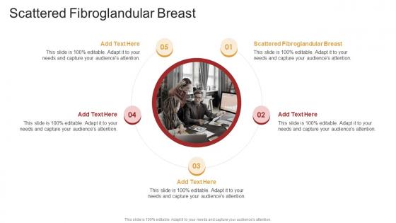 Scattered Fibroglandular Breast In Powerpoint And Google Slides Cpb