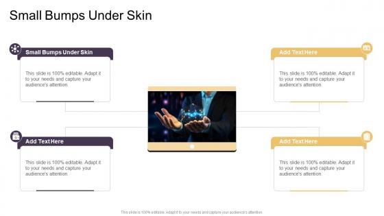 Small Bumps Under Skin In Powerpoint And Google Slides Cpb